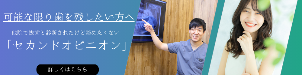 歯を残したい方【セカンドオピニオン】バナー