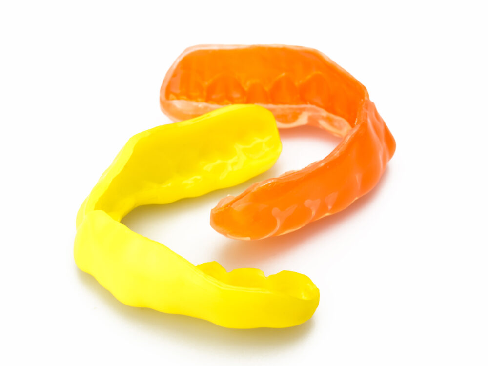 スポーツマウスピースとは？